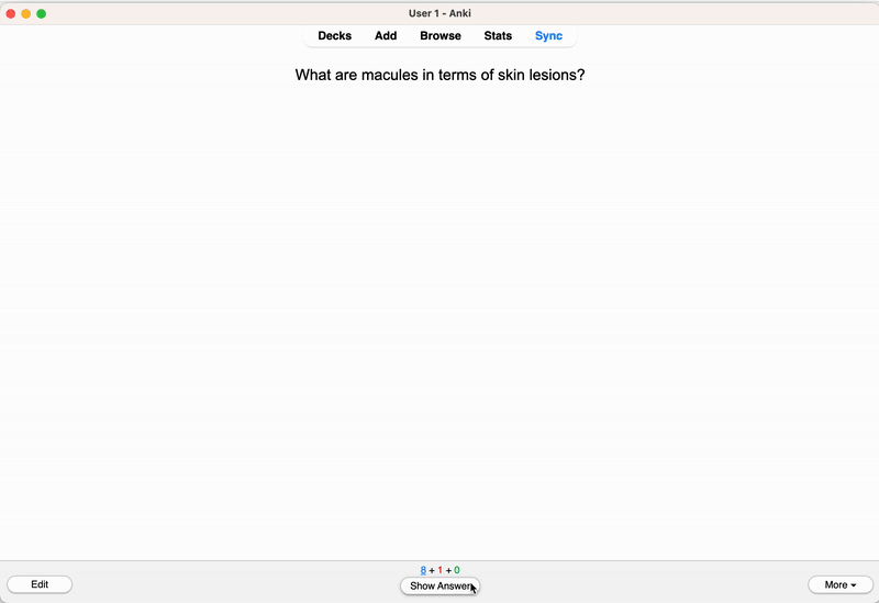 Anki interface